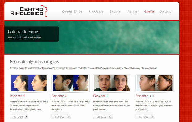 Estrategia de Marketing Online para difundir la operacion de nariz estetica en Cancun